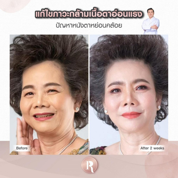 Slider image (4) Reals Aesthetic Center